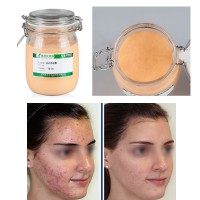 Face Care Acne Scar Removal Cream Acne Spots Skin Care Treatment Stretch Marks Oil Care Acne Treatment Cream